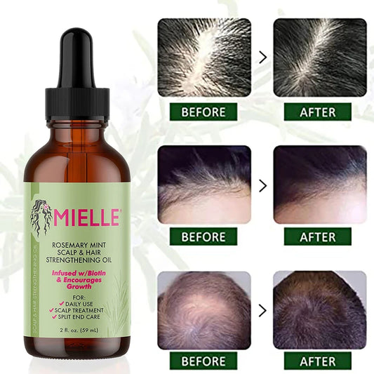 🌿 GlowRoot VitalOil – 100% Pure Rosemary Hair Growth Essential Oil