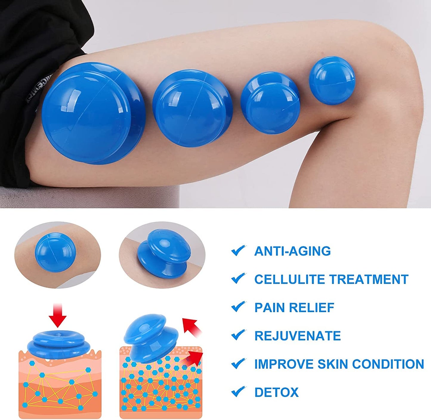 🌀GlowCupp Restore – Premium Cupping Therapy Set