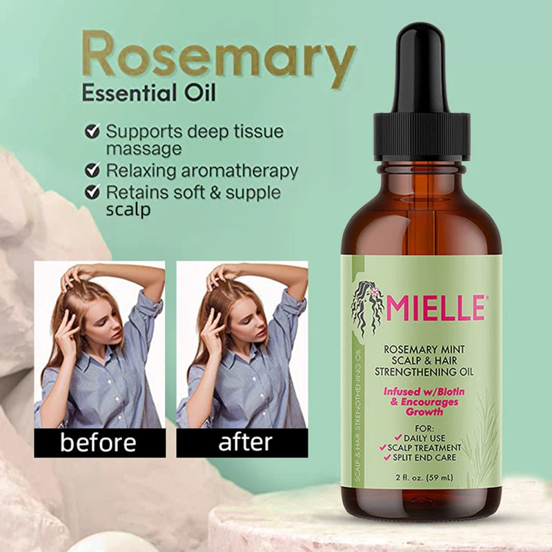 🌿 GlowRoot VitalOil – 100% Pure Rosemary Hair Growth Essential Oil