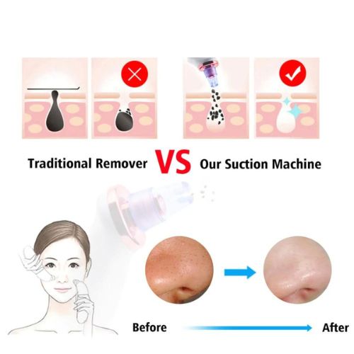 ✨ GlowSkin PoreSweep Pro – Vacuum Blackhead Remover & Deep Pore Cleaner