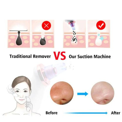 ✨ GlowSkin PoreSweep Pro – Vacuum Blackhead Remover & Deep Pore Cleaner