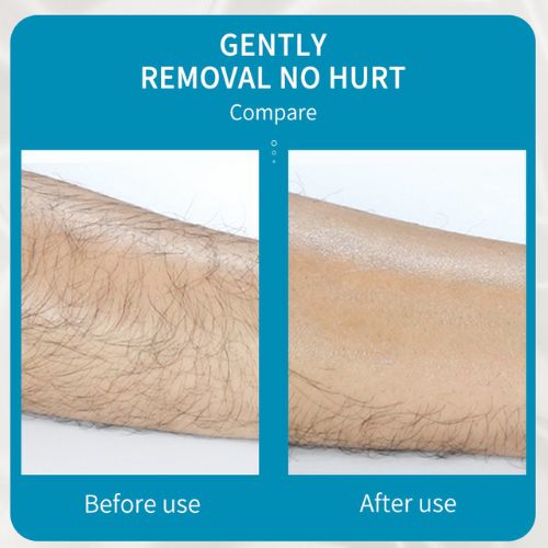 ✨ GlowSkin SmoothErase – Painless Crystal Hair Eraser & Exfoliator