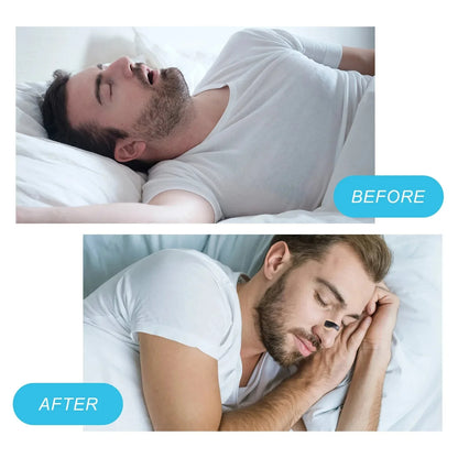 🌬 GlowBreathe IntakeTabs Pro – Extra-Strength Nasal Breathing Strips