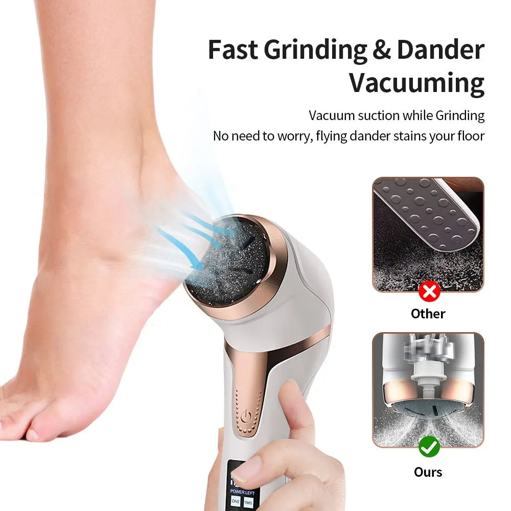 🦶 GlowCare SmoothPro – Rechargeable Electronic Foot File & Callus Remover