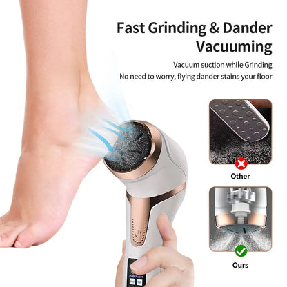 🦶 GlowCare SmoothPro – Rechargeable Electronic Foot File & Callus Remover