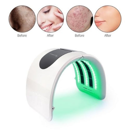 GlowSkin LumiWave – Safe LED Light Therapy Facial Device