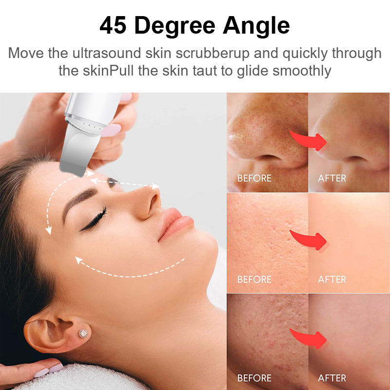 ✨ GlowLift SonicScrub – Ultrasonic Facial Skin Scrubber & Serum Infuser